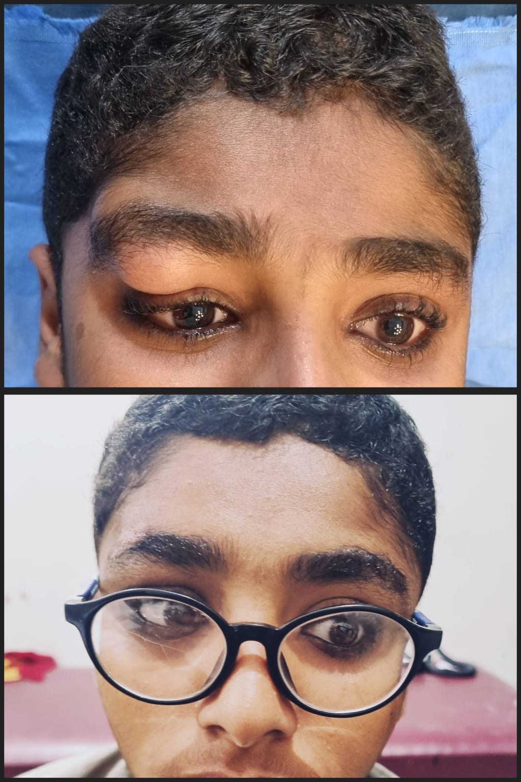 Before & After 60